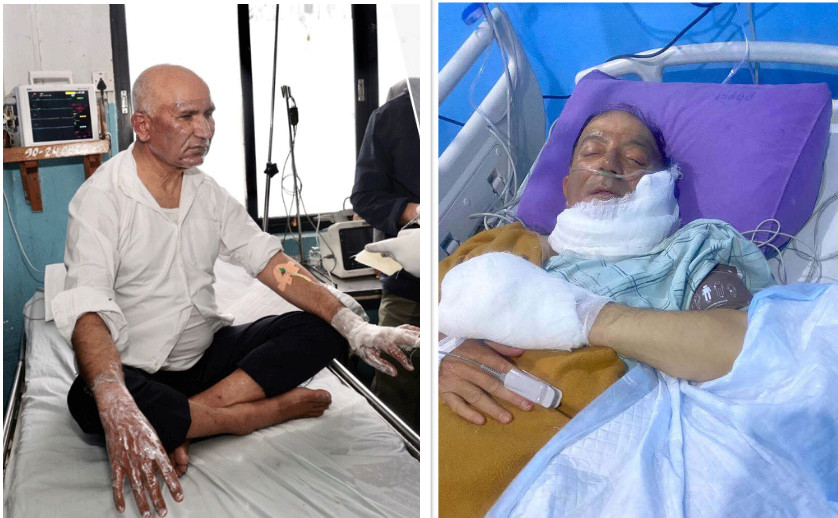 उपप्रधानमन्त्री पौडेल र मेयर आचार्यको स्वास्थ्यमा सुधार, भेटघाट गर्न बन्द